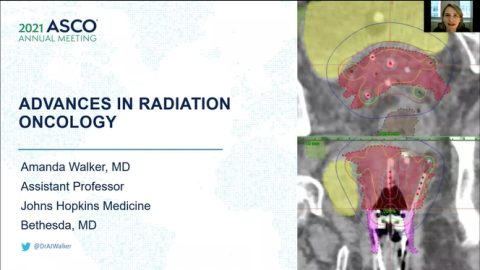 Advances in Radiation Oncology